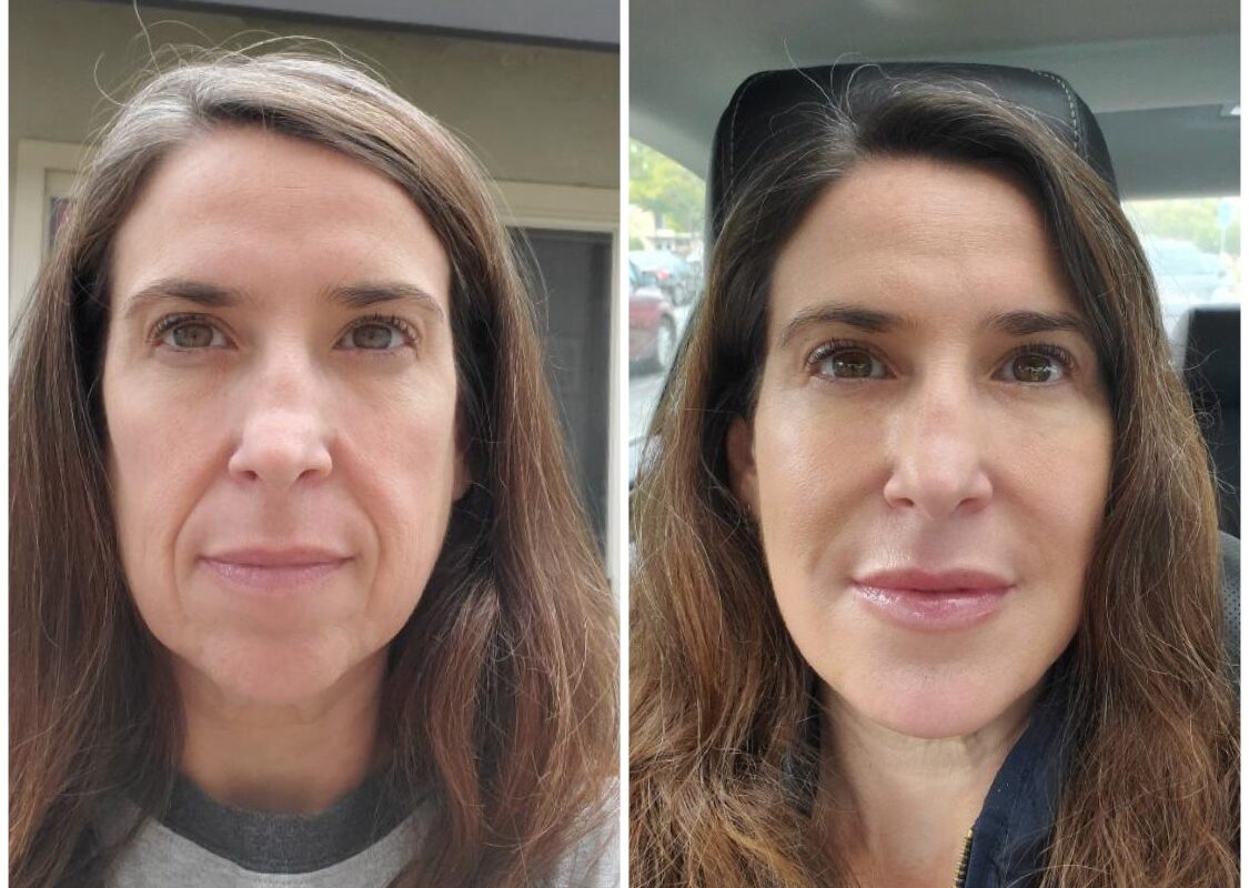 The Future of Aesthetic Medicine at Eternia Medspa