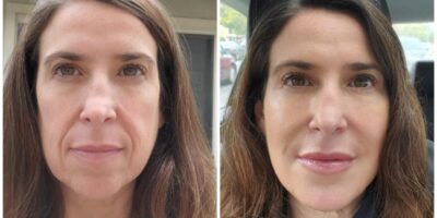 The Future of Aesthetic Medicine at Eternia Medspa
