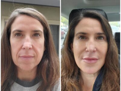 The Future of Aesthetic Medicine at Eternia Medspa